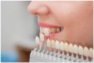 Что такое протезирование зубов