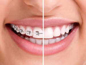 Стоматологическая клиника – профилактика, лечение, протезирование зубов и исправление прикуса