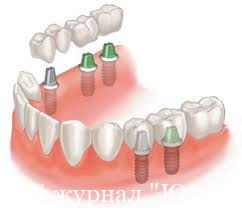 Лечение зубов цены и качество
